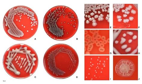 Escherichia Coli E Coli Morphology Arrangement Cultural