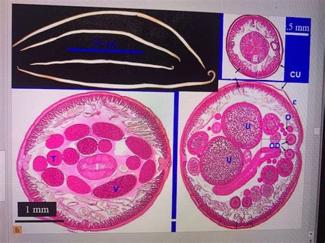 Exam 3 Lab Practical Ascariasis Ascaris Lumbricoides Diagram Quizlet