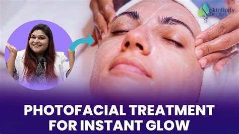 Photofacial Treatment Procedure For Instant Skin Glow Photofacial