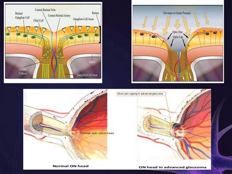 Anatomy of Optic Nerve | PPT