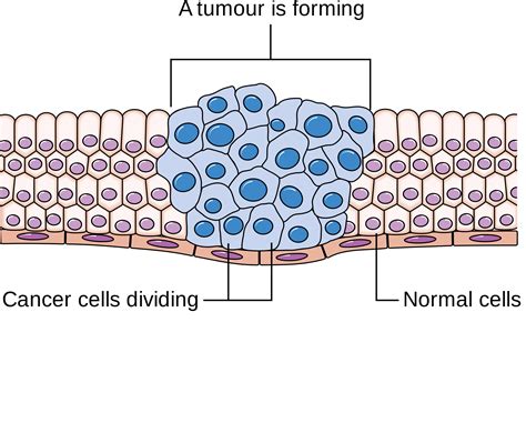 Cancer Cell Types