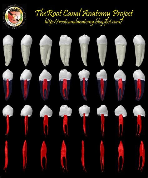The Root Canal Anatomy Project: May 2011