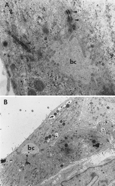 Transmission Electron Micrograph Of Picm Cells Grown In Sto