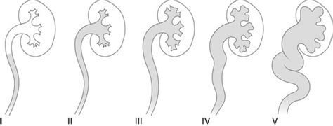 Vesicoureteral Reflux Clinical Gate