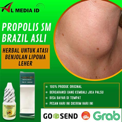 Jual COD Obat Tetes Benjolan Lipoma Propolis Sm Brazilian 100 Asli