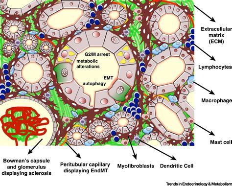 Partial Epithelial To Mesenchymal Transition And Other New Mechanisms