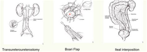 Urology Flashcards Quizlet