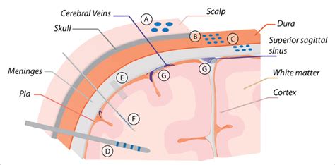 Electrode Types A Scalp Electrodes Scalp Download Scientific Diagram