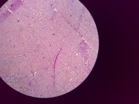 Cerebrum and Cerebellum – howMed