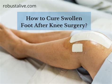 Best Way To Cure Swollen Foot After Knee Surgery