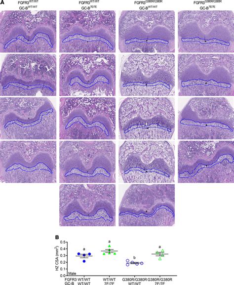 Gc B 7e 7e Expression Rescues Growth Plate Hypertrophic Zone Reductions