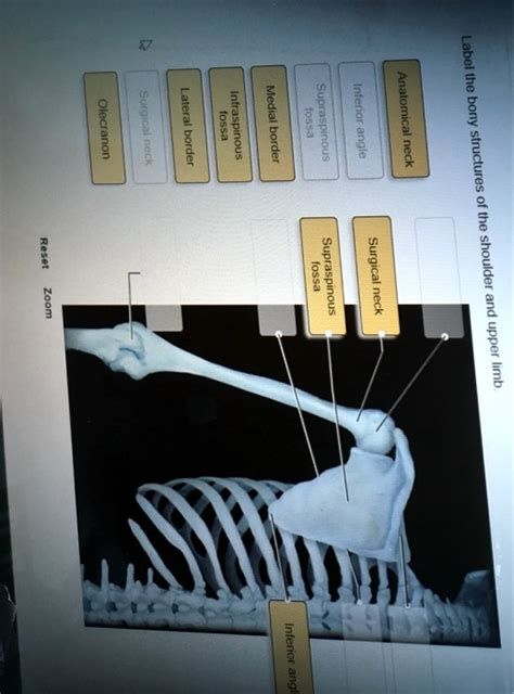 Solved Olecranon Surgical Neck Lateral Border Fossa Infraspinous