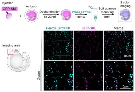 Peroxi Spy Peroxisome Live Cell Probe Spirochrome