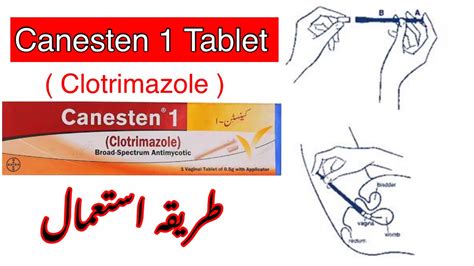 How To Use Canesten Tablet Clotrimazole Fungal Infection Yeast