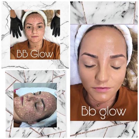 Bb Glow Natural Skin Care Diy Facial Before And After Skin Solutions