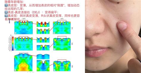 法令纹很深怎么消除？【皮肤科医生】教你4步对抗法令纹等干纹细纹，30 还有20 的肌肤状态！ 知乎