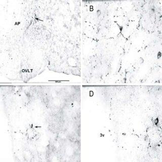 The Population Of Immunoreactive Kisspeptin Perikarya And Fibres In The