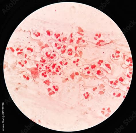 Gram Positive Cocci Under Microscope