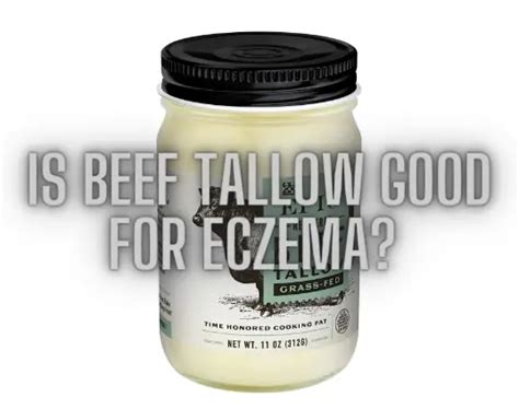 Is Beef Tallow Good For Eczema? – EczemaFeed