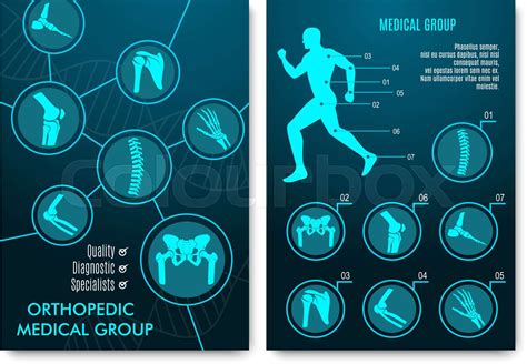 Medical Infographic With Orthopedic Anatomy Charts Stock Vector