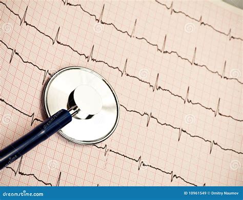 Stethoscope On Ekg Stock Image Image Of Check Chart 10961549