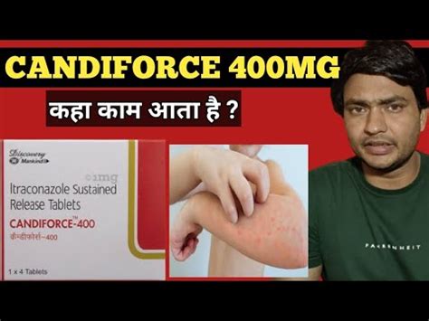 Candiforce 400 Mg Capsule Use In Hindi Itraconazole Capsule Review