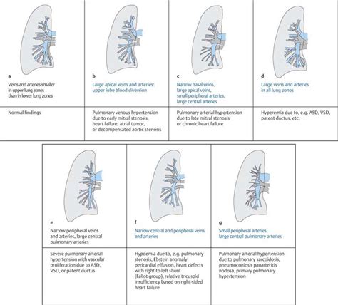 Conventional Radiography Radiology Key