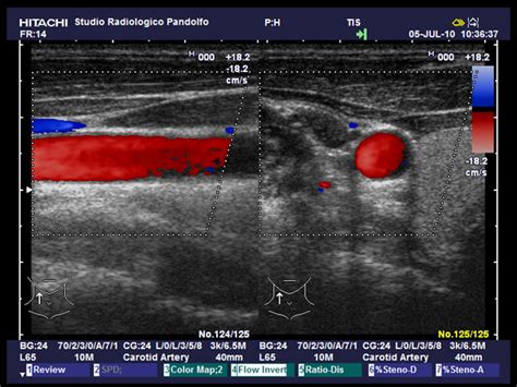 Eco Color Doppler Studio Radiologico Pandolfo Diagnostica Per