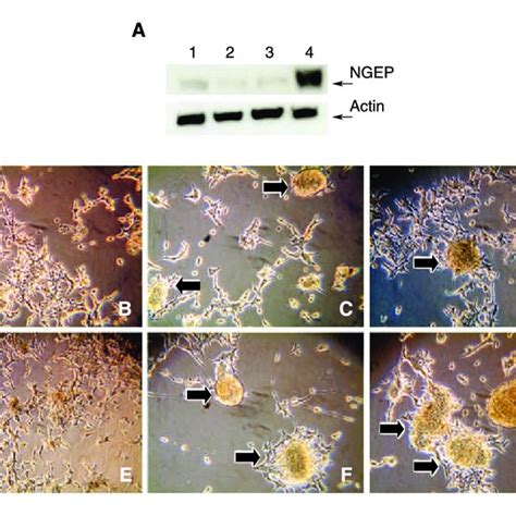 Expression Of NGEP L In The LNCaP Cells Alters The Morphology Of The