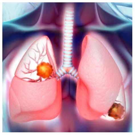 world lung day create enabling environment  ensure healthy lungs