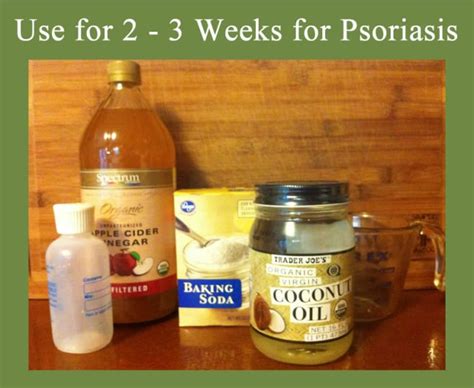 Homemade Natural Psoriasis Shampoo - RemedyGrove