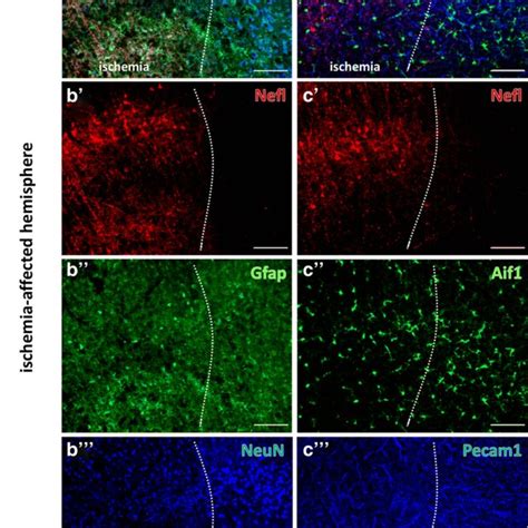 Immunolabeling Of The Neurofilament L Nefl Combined With Astroglial