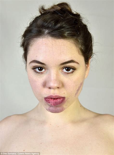 Model Celina Leroy Who Spent 15k Trying To Cover Facial Birthmark Goes