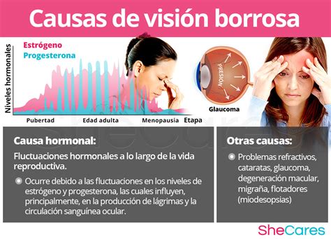 Vista Nublada Causas Y Soluciones Claridad Mental