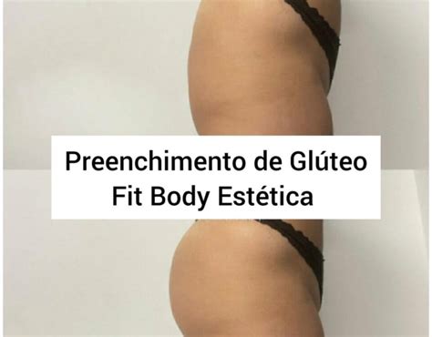 Arquivos tipos de preenchimento para glúteo Clínica Fit Body Estética