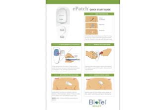 Philips Extended Holter – ePatch – My Heart Monitor