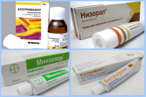 Цветной лишай чем лечить: Как бороться с отрубевидным лишаем — блог ...