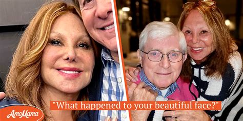 Marlo Thomas Face Labeled Weird But Her Spouse Accepts Her As She Is