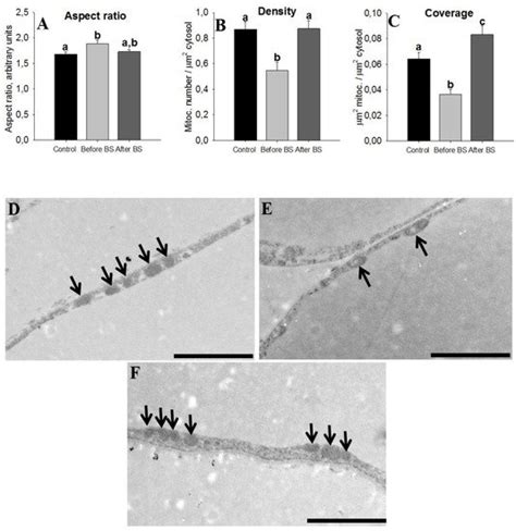 Jcm Free Full Text Beneficial Effects Of Bariatric Surgery Induced