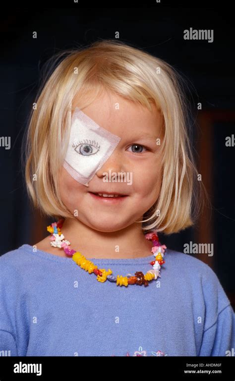 The girl had to wear an eye-patch so her father made her a new eye ...