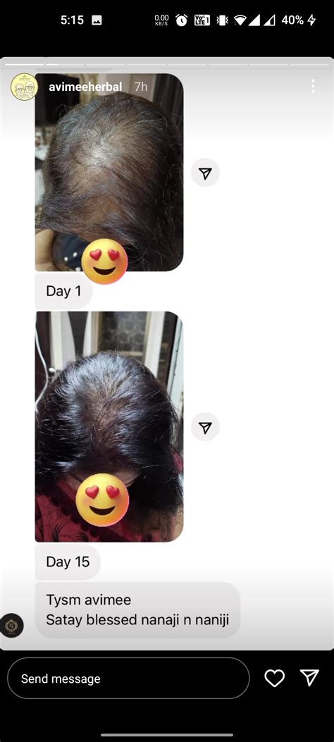 15 days? That feels really unbelievable. What do you guys think? : r ...