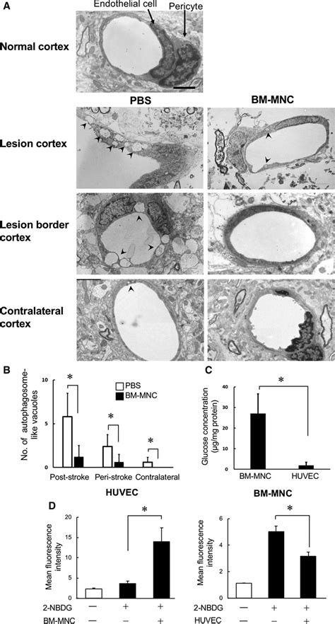 Bone Marrow Mononuclear Cells Activate Angiogenesis Via Gap Junction