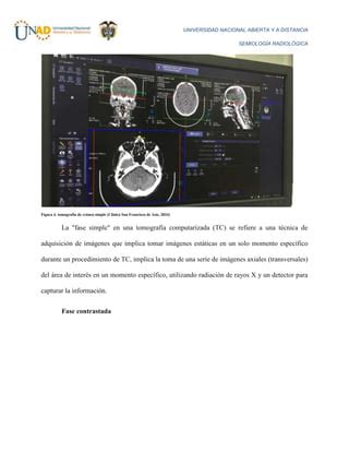 Técnica de Tomografía computarizada docx Descarga Gratuita