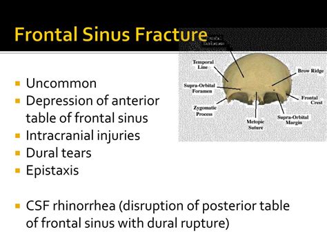 maxillofacial trauma powerpoint    id
