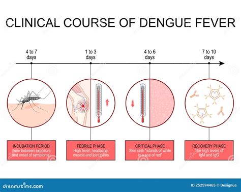 Dengue Fever Stages