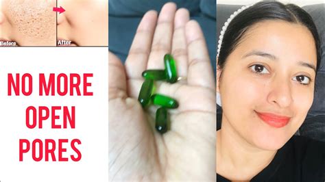 How To Get Glass Skin Naturally At Home Vitamin E Capsule