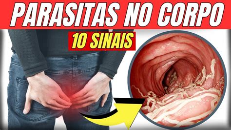 10 Sintomas De PARASITAS No Corpo Identifique E Combata YouTube