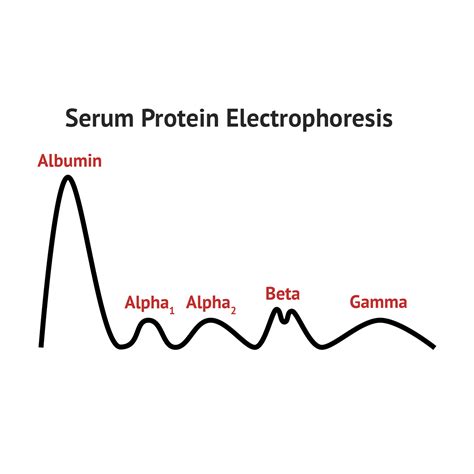 Serum Protein Electrophoresis | Serum, Medical laboratory technician ...