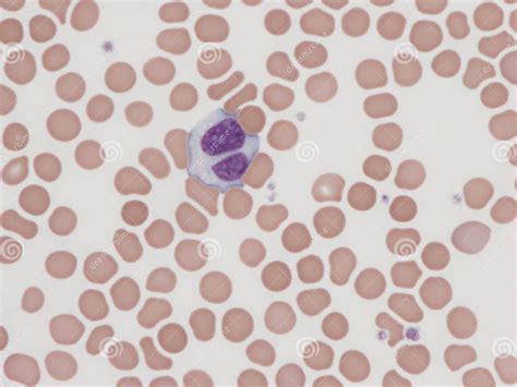 Binucleated Lymphocyte Stock Illustration Illustration Of Hematology 278929931