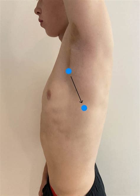 Posterior And Lateral Thorax Auscultation Nursing Physical